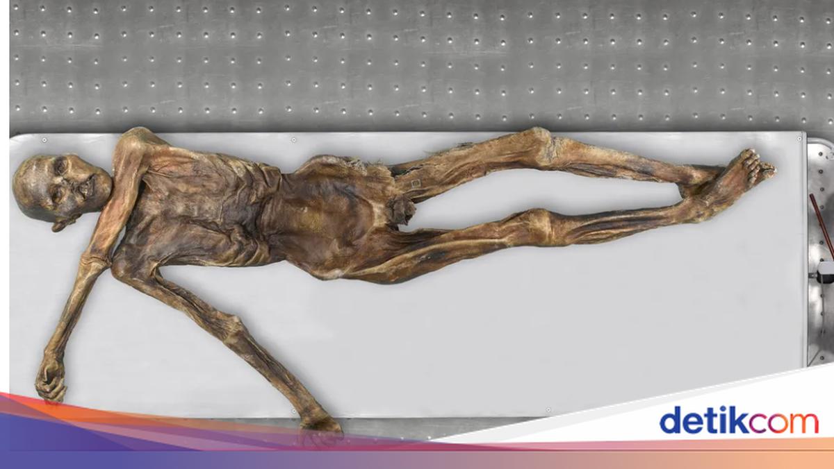 Mengejutkan! Kehidupan Mikroba Berusia Ribuan Tahun di Mumi Otzi